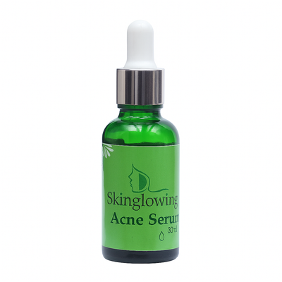 Skinglowing Acne Serum – Oil Control & Scar Repair (30ml)